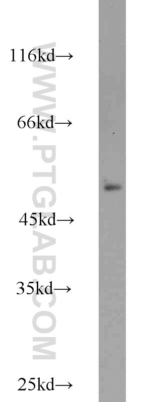 Western Blot (WB) analysis of mouse ovary tissue using MRPL37 Polyclonal antibody (15190-1-AP)