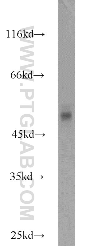 Western Blot (WB) analysis of mouse uterus tissue using MRPL37 Polyclonal antibody (15190-1-AP)