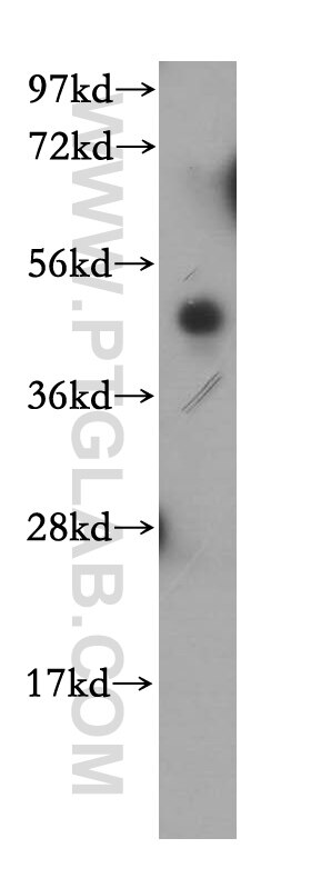 Western Blot (WB) analysis of human heart tissue using MRPL37 Polyclonal antibody (15190-1-AP)