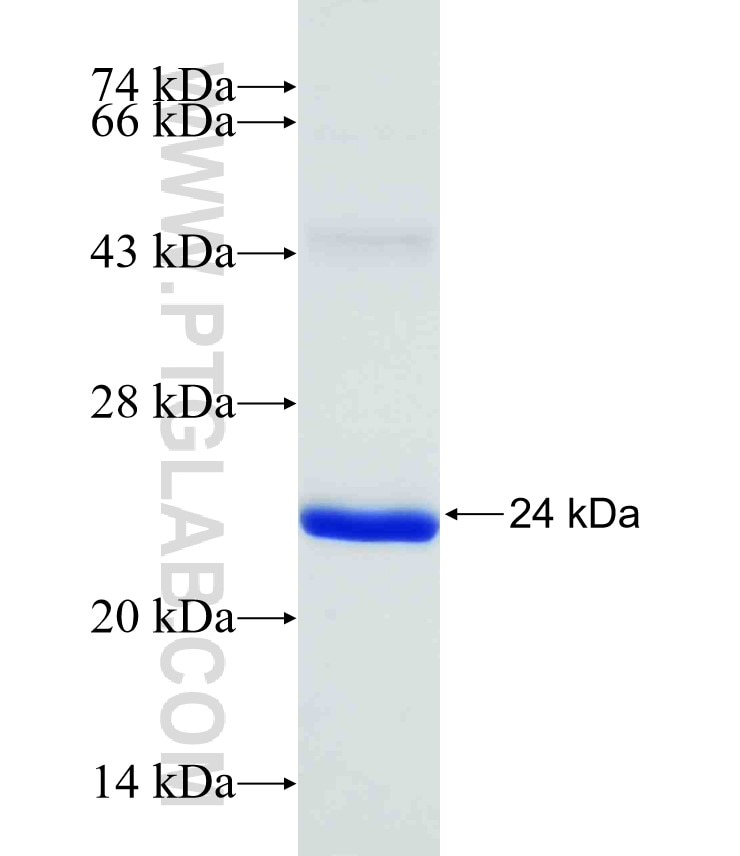 MRPL37 fusion protein Ag31452 SDS-PAGE