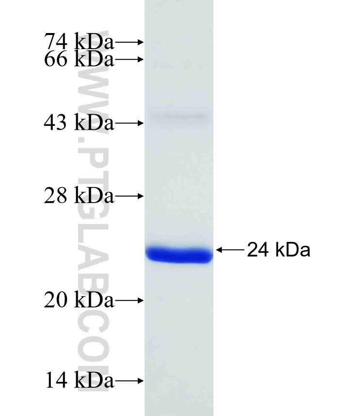 MRPL37 fusion protein Ag31452 SDS-PAGE