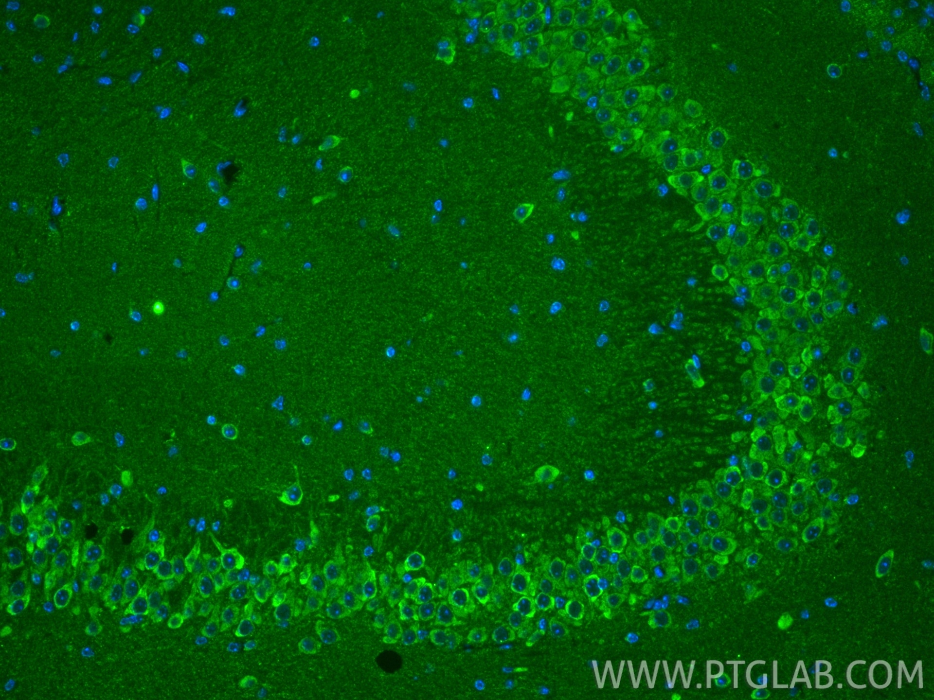 IF Staining of mouse brain using 15913-1-AP Immunofluorescence (IF) / fluorescent staining of mouse brain tissue using MRPL38 Polyclonal antibody (15913-1-AP)