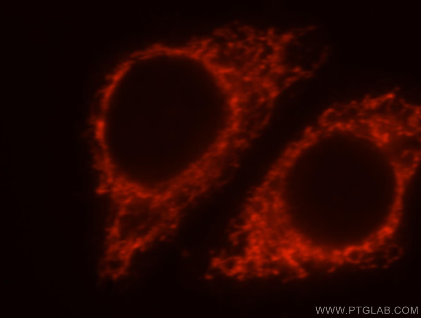 Immunofluorescence (IF) / fluorescent staining of HepG2 cells using MRPL38 Polyclonal antibody (15913-1-AP)