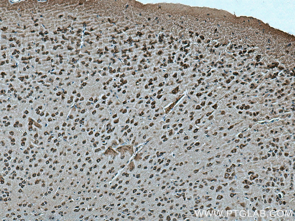 Immunohistochemistry (IHC) staining of mouse brain tissue using MRPL38 Polyclonal antibody (15913-1-AP)
