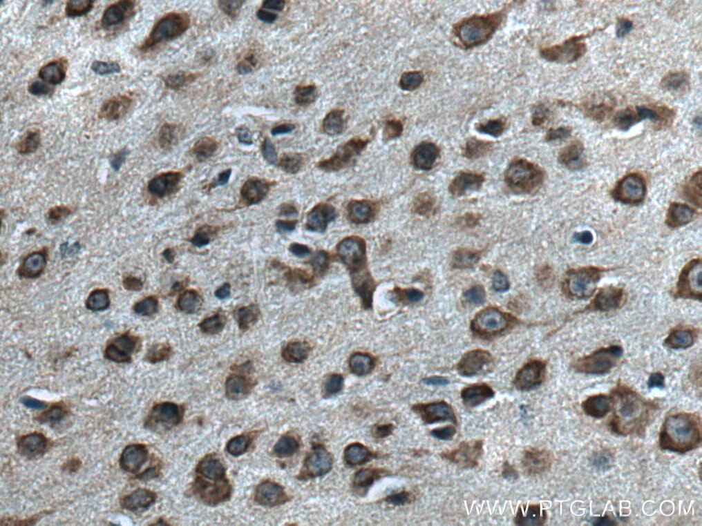 Immunohistochemistry (IHC) staining of mouse brain tissue using MRPL38 Polyclonal antibody (15913-1-AP)