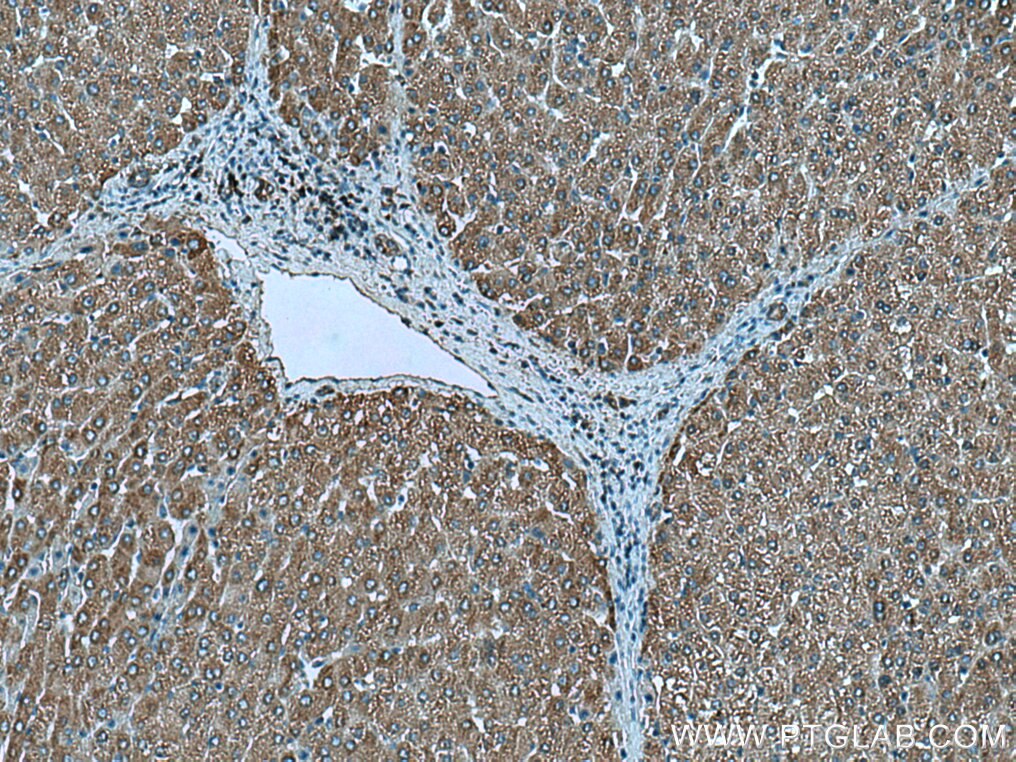 Immunohistochemistry (IHC) staining of human liver tissue using MRPL38 Polyclonal antibody (15913-1-AP)