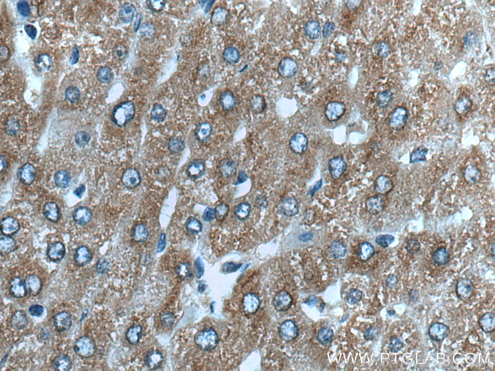 Immunohistochemistry (IHC) staining of human liver tissue using MRPL38 Polyclonal antibody (15913-1-AP)