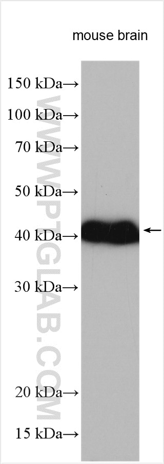 Western Blot (WB) analysis of various lysates using MRPL38 Polyclonal antibody (15913-1-AP)