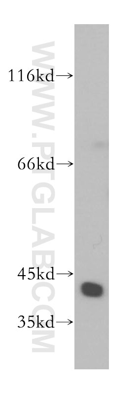 Western Blot (WB) analysis of mouse brain tissue using MRPL38 Polyclonal antibody (15913-1-AP)