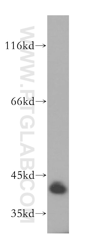 Western Blot (WB) analysis of mouse liver tissue using MRPL38 Polyclonal antibody (15913-1-AP)