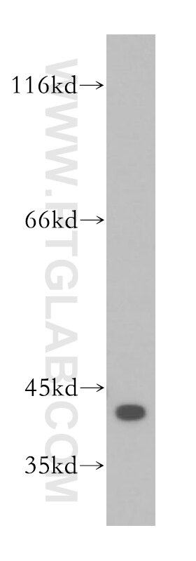 Western Blot (WB) analysis of human placenta tissue using MRPL38 Polyclonal antibody (15913-1-AP)