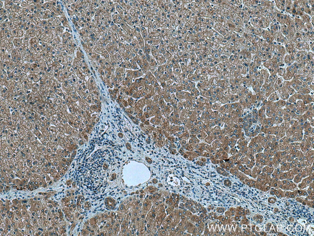 Immunohistochemistry (IHC) staining of human liver tissue using MRPL39 Polyclonal antibody (28165-1-AP)