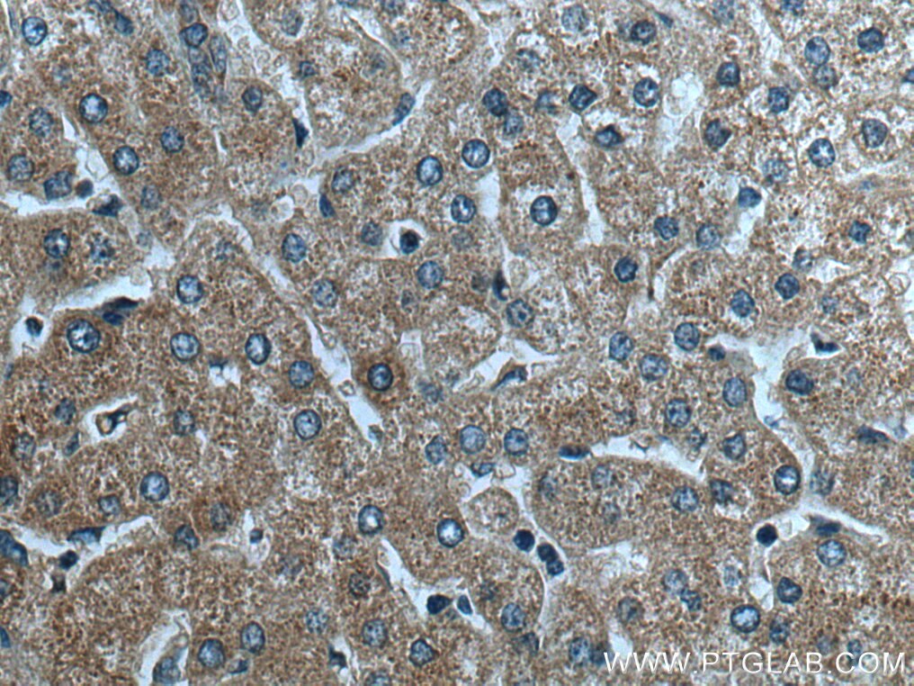 Immunohistochemistry (IHC) staining of human liver tissue using MRPL39 Polyclonal antibody (28165-1-AP)