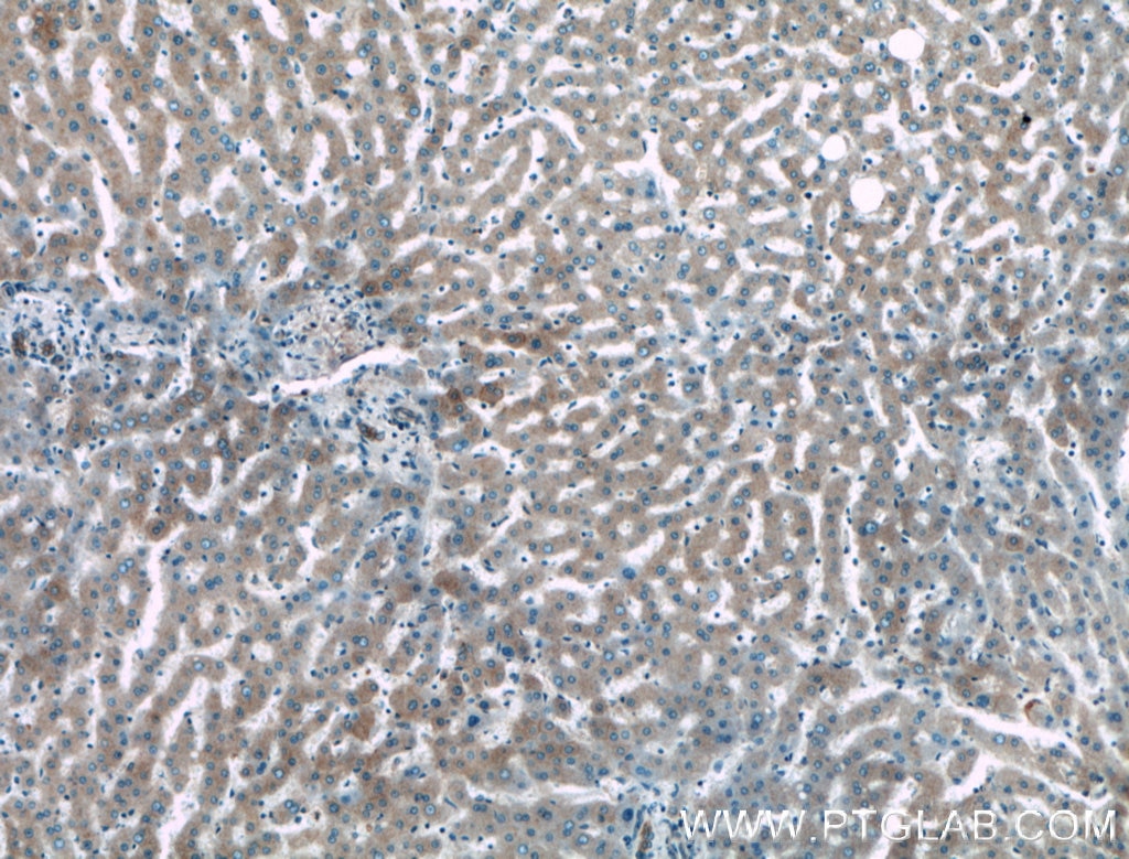 Immunohistochemistry (IHC) staining of human liver tissue using MRPL4 Polyclonal antibody (27484-1-AP)