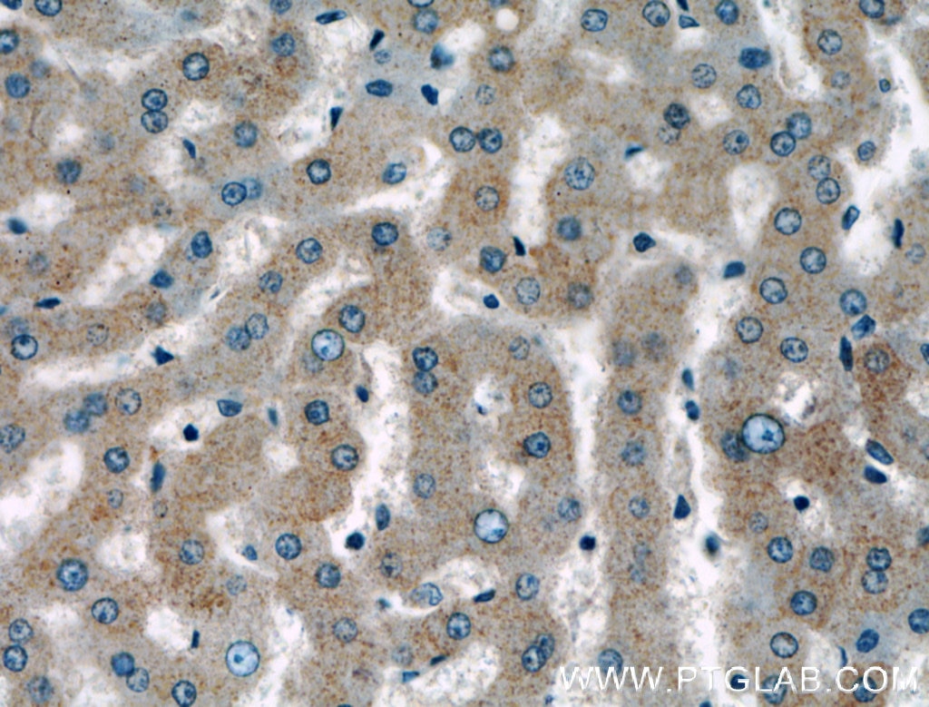 Immunohistochemistry (IHC) staining of human liver tissue using MRPL4 Polyclonal antibody (27484-1-AP)