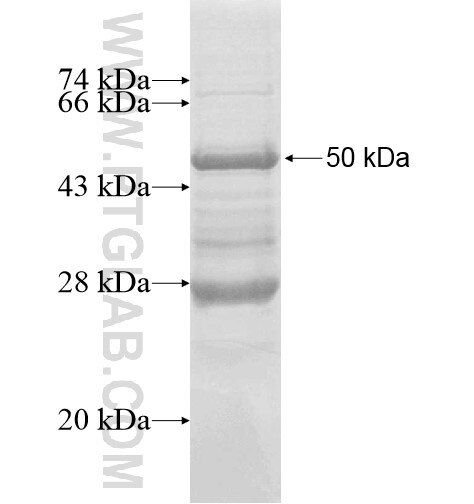 MRPL40 fusion protein Ag10341 SDS-PAGE