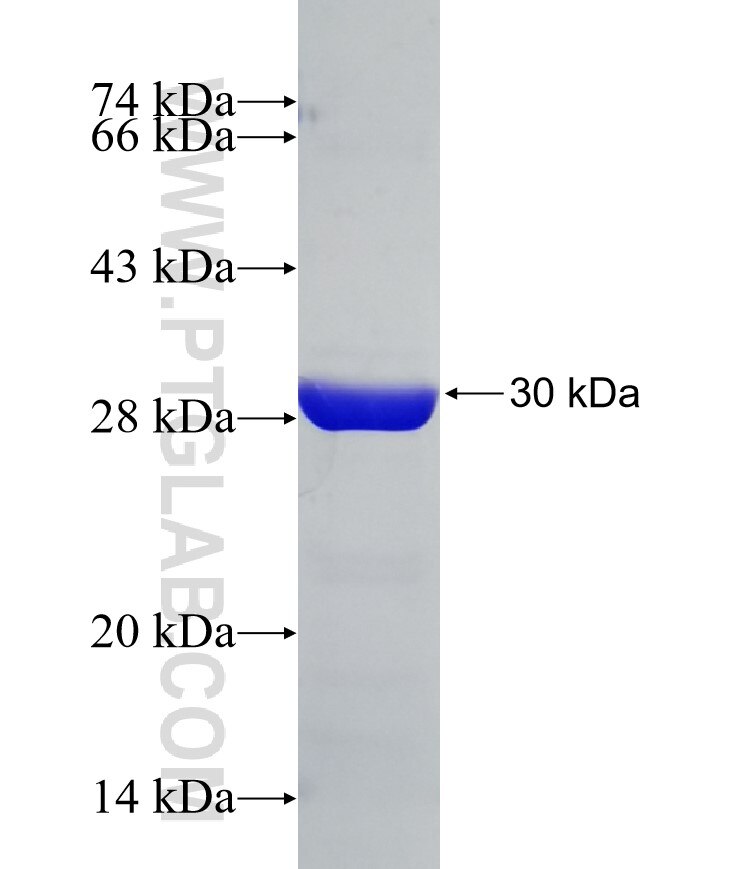 MRPL40 fusion protein Ag10477 SDS-PAGE