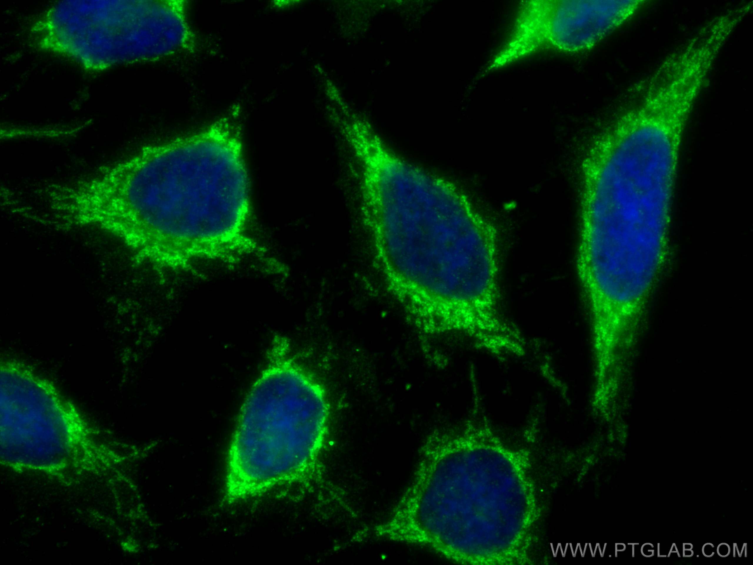 Immunofluorescence (IF) / fluorescent staining of HeLa cells using MRPL42 Polyclonal antibody (17300-1-AP)