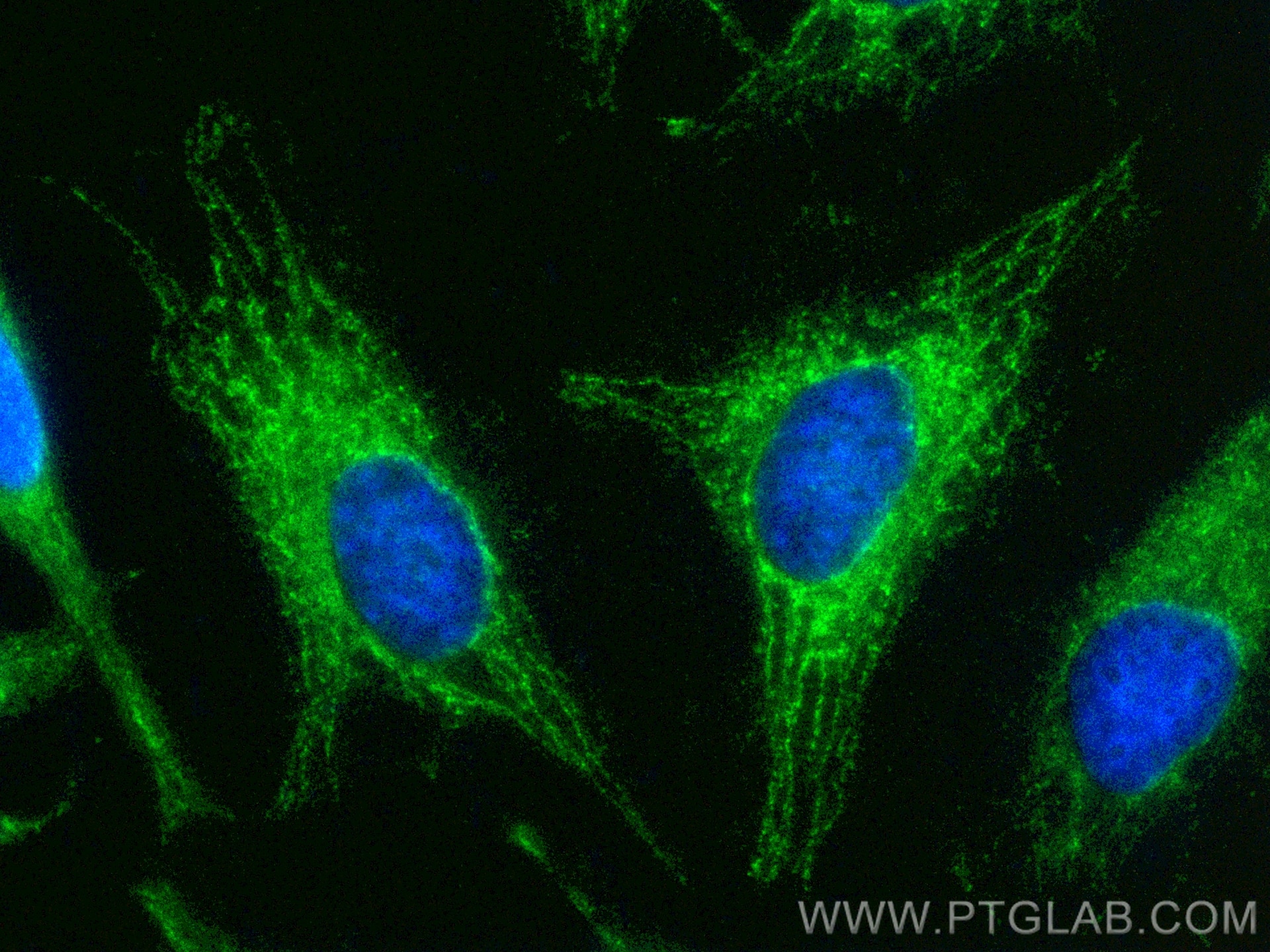 Immunofluorescence (IF) / fluorescent staining of HeLa cells using CoraLite® Plus 488-conjugated MRPL42 Polyclonal an (CL488-17300)