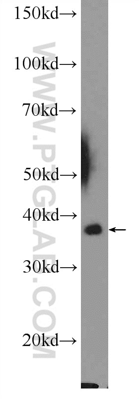Western Blot (WB) analysis of rat brain tissue using MRPL44 Polyclonal antibody (16394-1-AP)