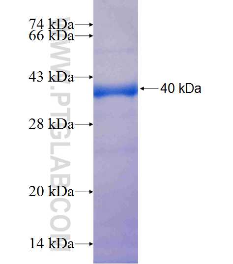 MRPL44 fusion protein Ag9467 SDS-PAGE