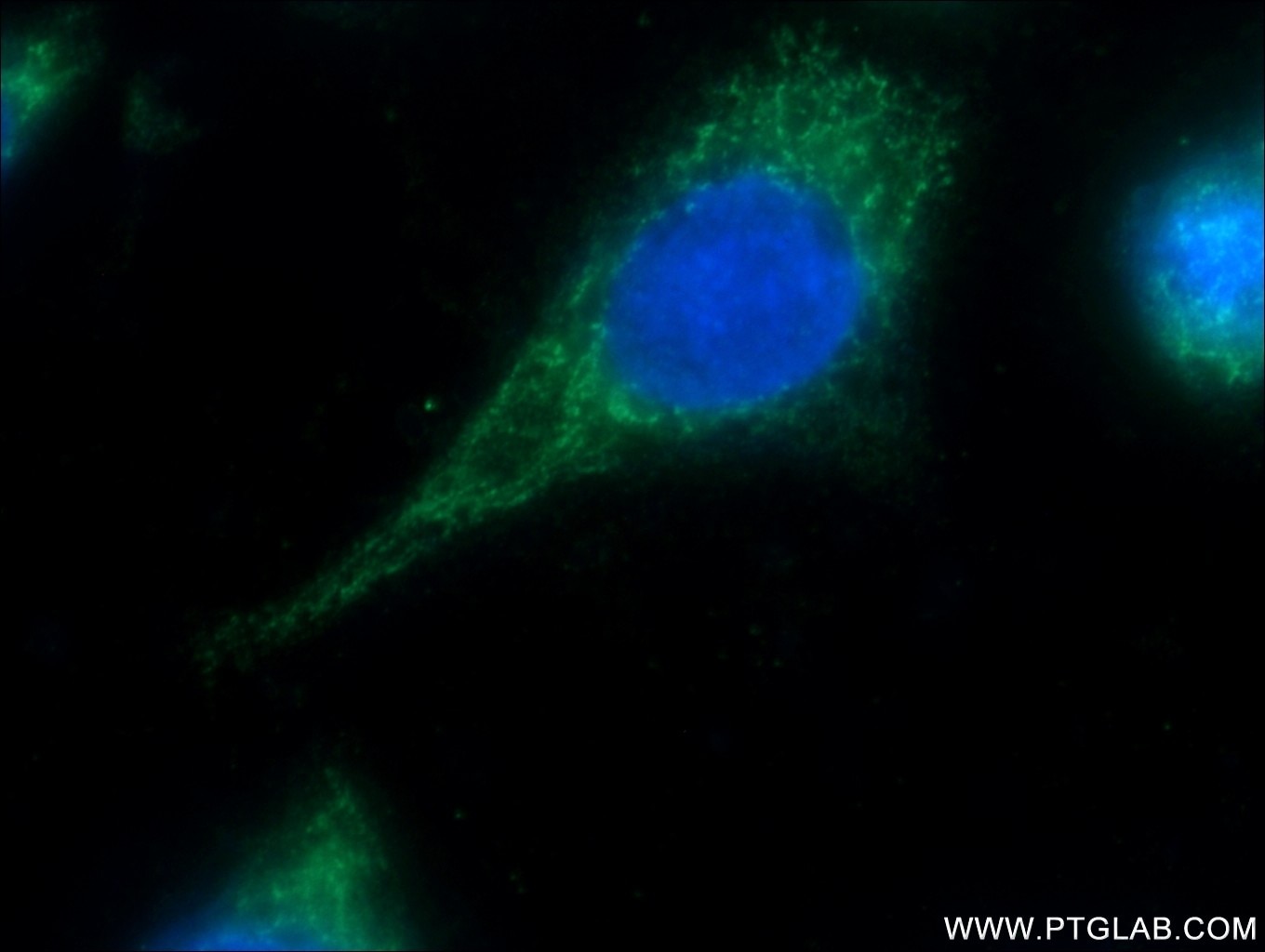 Immunofluorescence (IF) / fluorescent staining of HeLa cells using MRPL45 Polyclonal antibody (15682-1-AP)