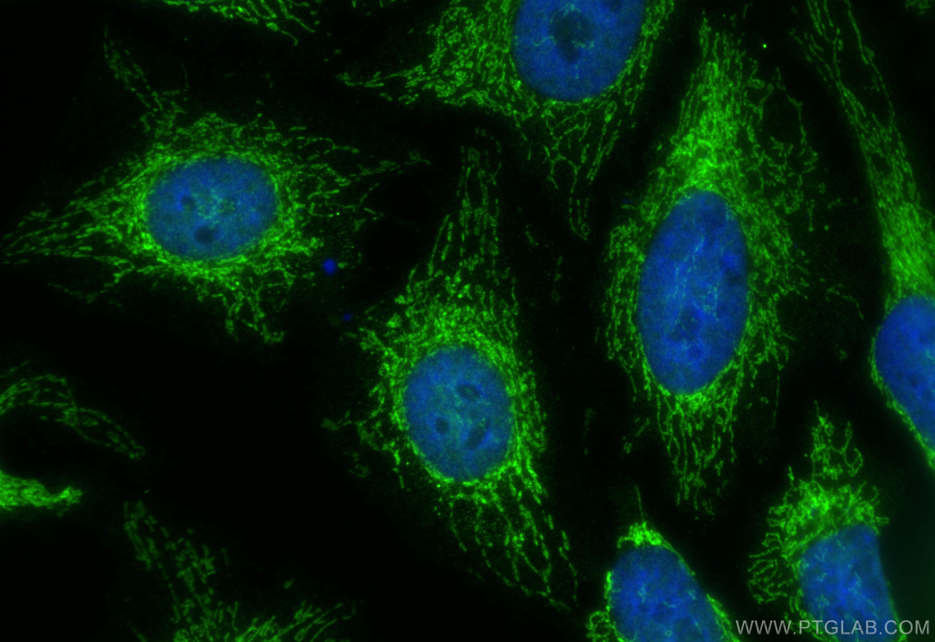 Immunofluorescence (IF) / fluorescent staining of HeLa cells using MRPL45 Polyclonal antibody (15682-1-AP)