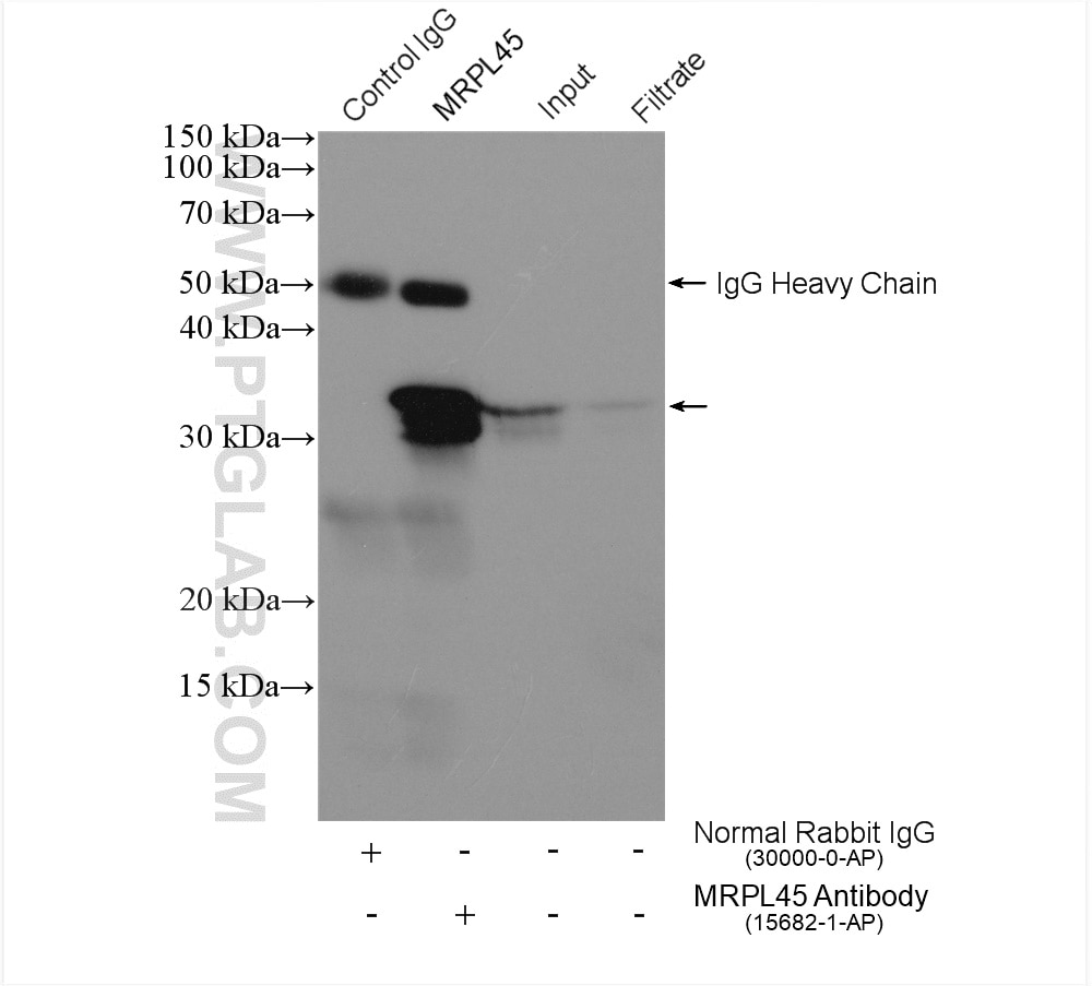 IP experiment of HeLa using 15682-1-AP