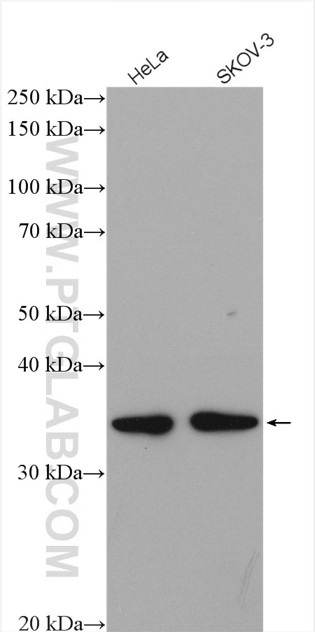 Western Blot (WB) analysis of various lysates using MRPL45 Polyclonal antibody (15682-1-AP)