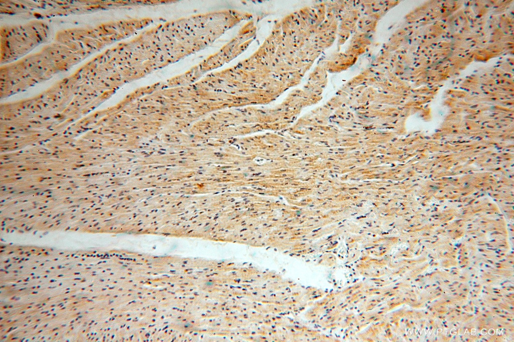 Immunohistochemistry (IHC) staining of human heart tissue using MRPL46 Polyclonal antibody (16611-1-AP)