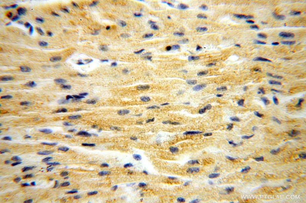 Immunohistochemistry (IHC) staining of human heart tissue using MRPL46 Polyclonal antibody (16611-1-AP)