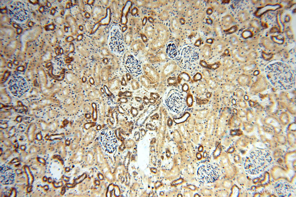 Immunohistochemistry (IHC) staining of human kidney tissue using MRPL46 Polyclonal antibody (16611-1-AP)