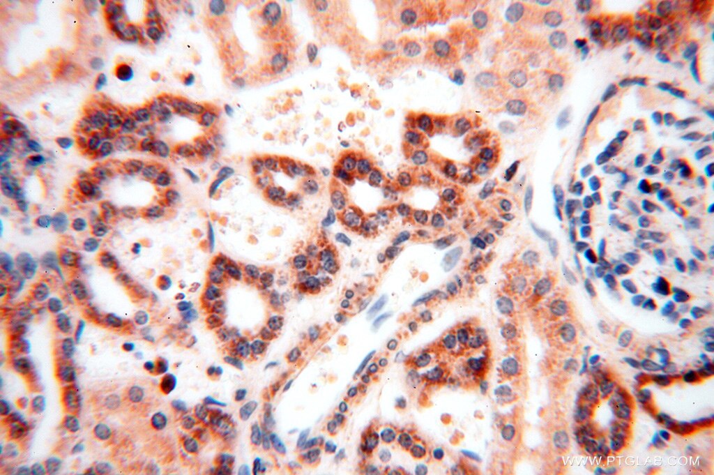 Immunohistochemistry (IHC) staining of human kidney tissue using MRPL46 Polyclonal antibody (16611-1-AP)