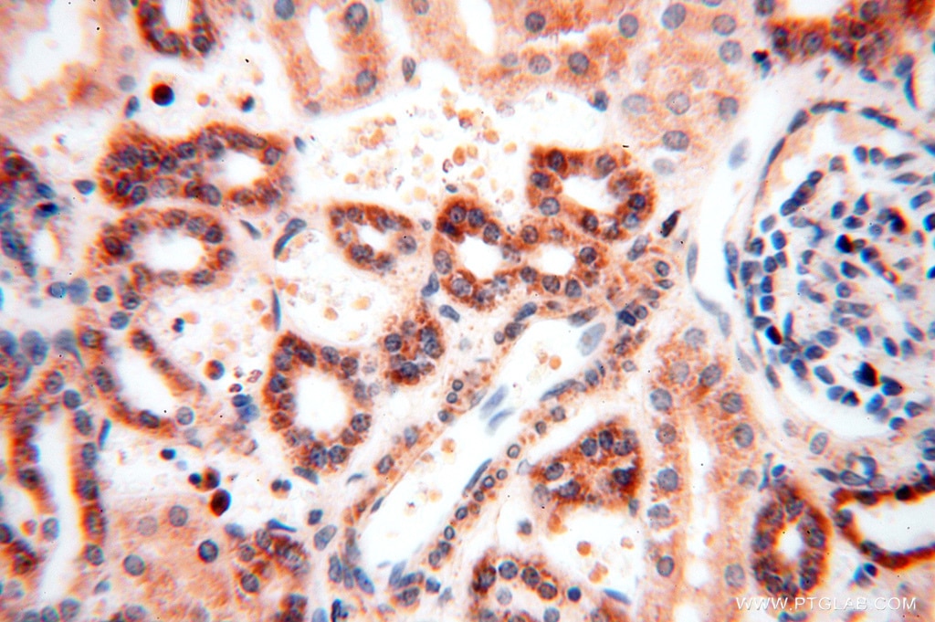 IHC staining of human kidney using 16611-1-AP