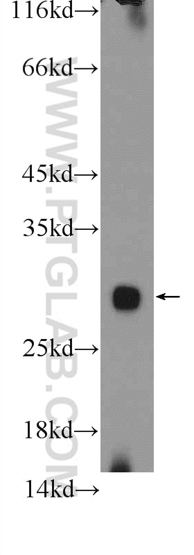 Western Blot (WB) analysis of mouse testis tissue using MRPL47 Polyclonal antibody (24728-1-AP)
