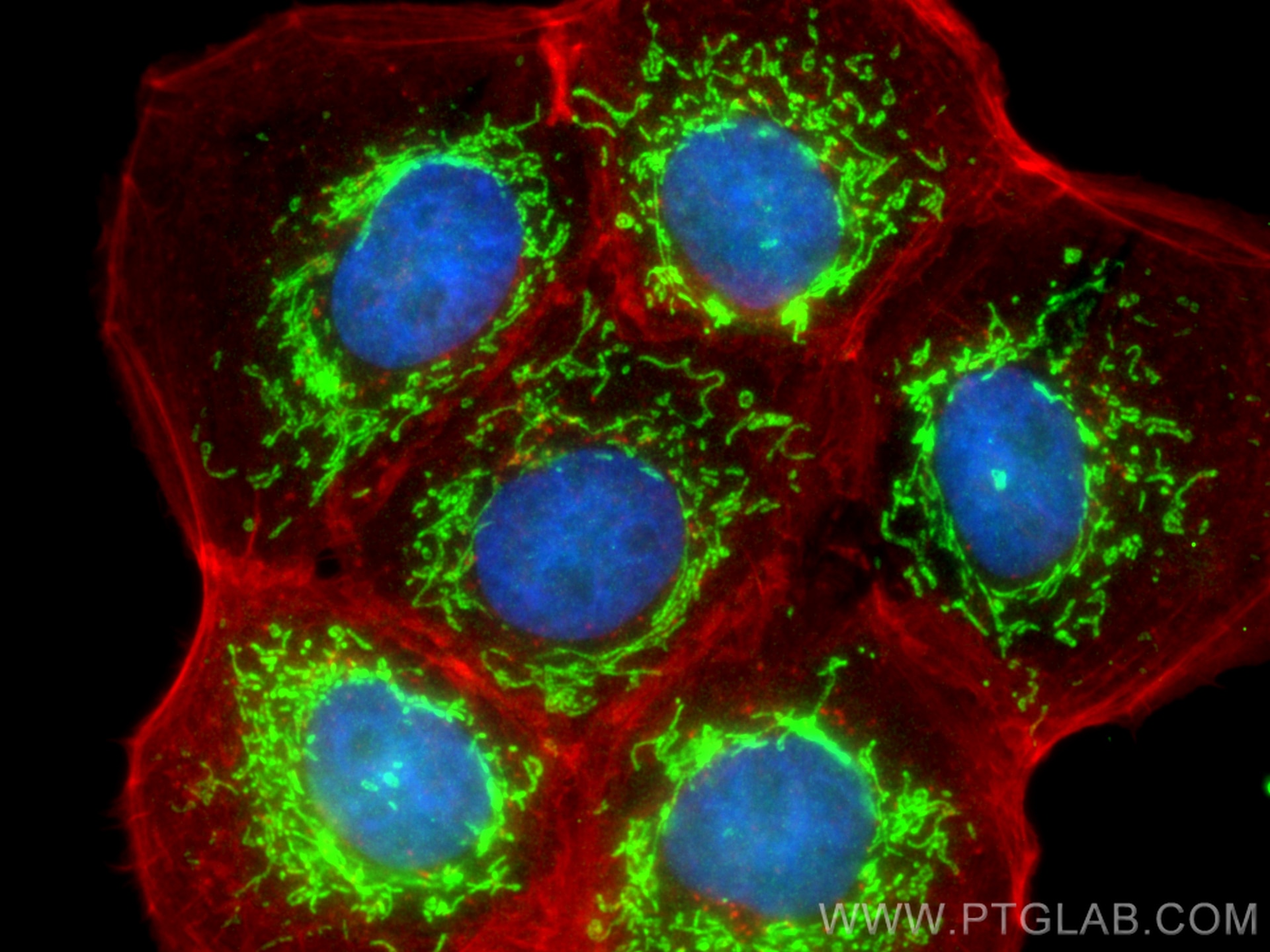 Immunofluorescence (IF) / fluorescent staining of A431 cells using MRPL48 Polyclonal antibody (14677-1-AP)
