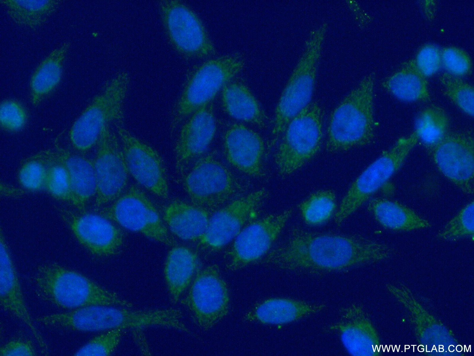 Immunofluorescence (IF) / fluorescent staining of HeLa cells using MRPL48 Polyclonal antibody (14677-1-AP)