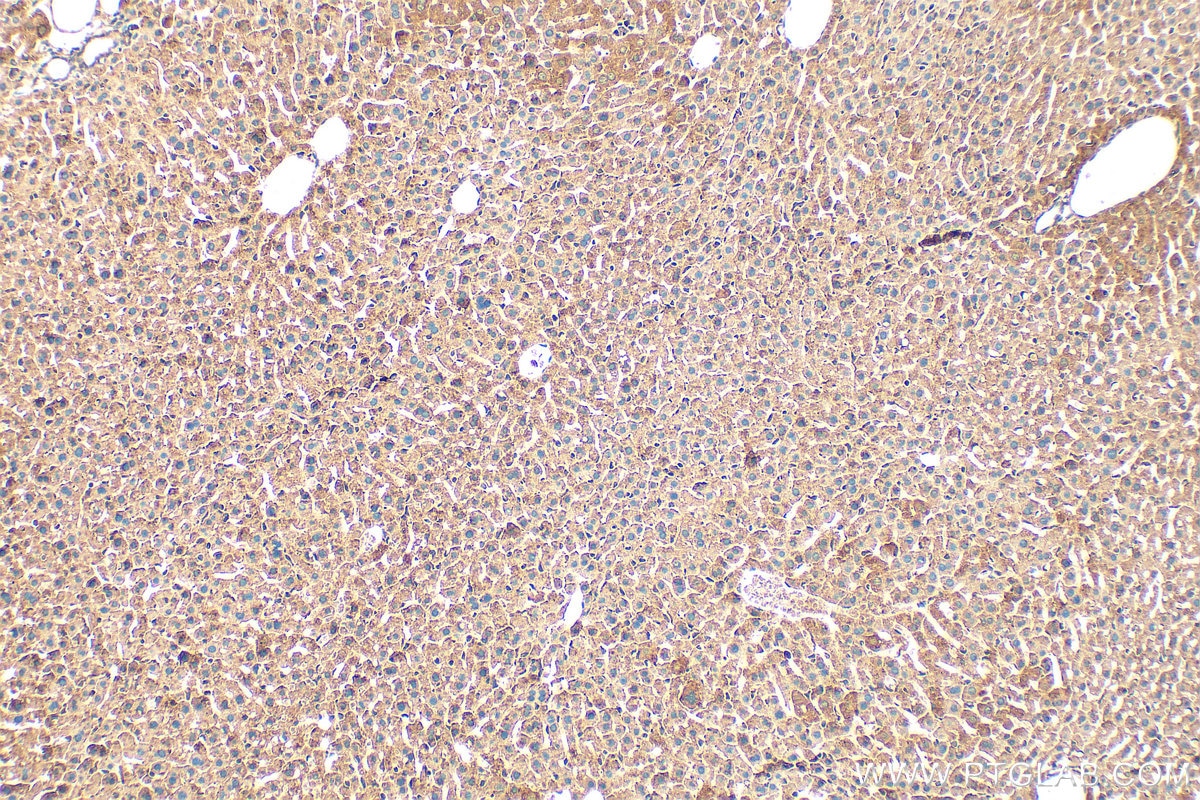 Immunohistochemistry (IHC) staining of mouse liver tissue using MRPL48 Polyclonal antibody (14677-1-AP)