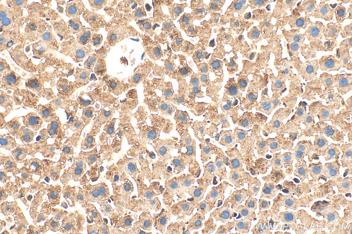 Immunohistochemistry (IHC) staining of mouse liver tissue using MRPL48 Polyclonal antibody (14677-1-AP)