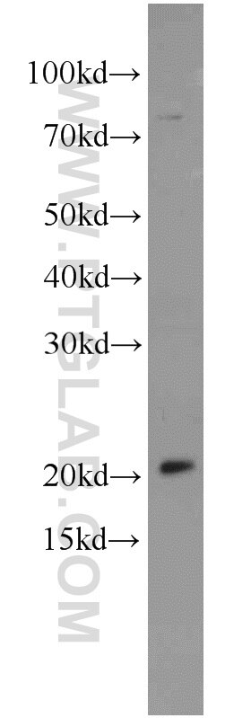 WB analysis of Jurkat using 14677-1-AP