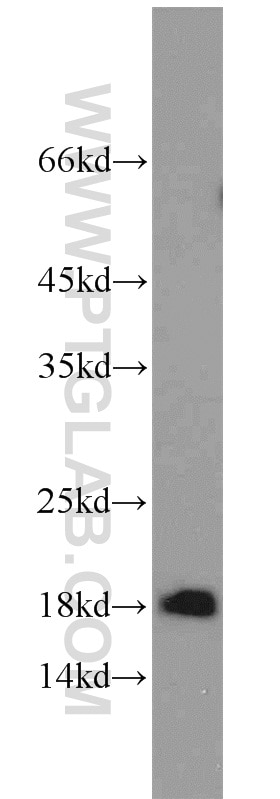 Western Blot (WB) analysis of HeLa cells using MRPL49 Polyclonal antibody (15542-1-AP)