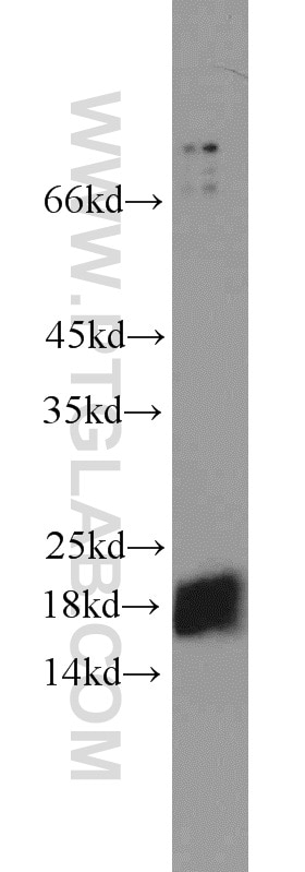 Western Blot (WB) analysis of A549 cells using MRPL49 Polyclonal antibody (15542-1-AP)