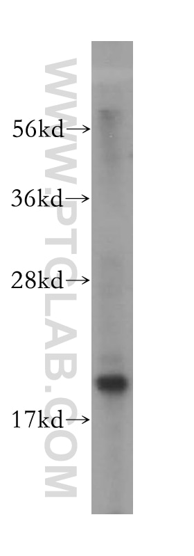 Western Blot (WB) analysis of HeLa cells using MRPL49 Polyclonal antibody (15542-1-AP)
