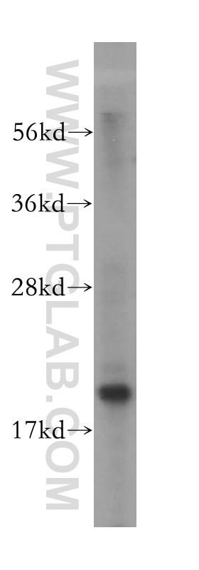 WB analysis of HeLa using 15542-1-AP