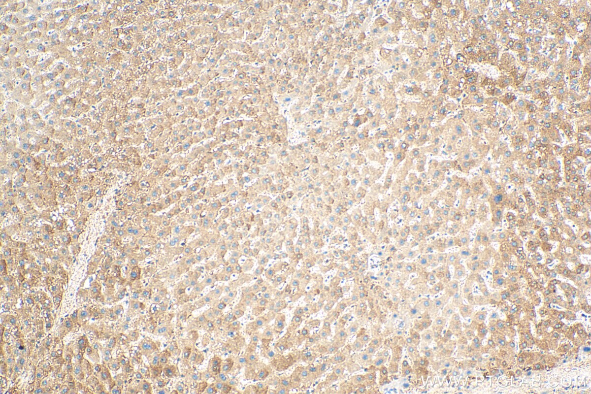 Immunohistochemistry (IHC) staining of human liver tissue using MRPL50 Polyclonal antibody (17213-1-AP)