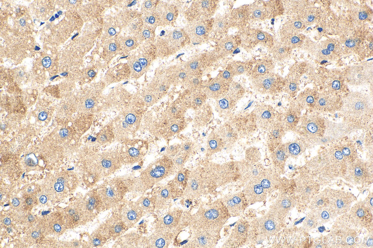 Immunohistochemistry (IHC) staining of human liver tissue using MRPL50 Polyclonal antibody (17213-1-AP)