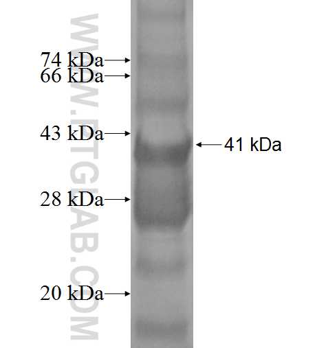 MRPL51 fusion protein Ag7193 SDS-PAGE