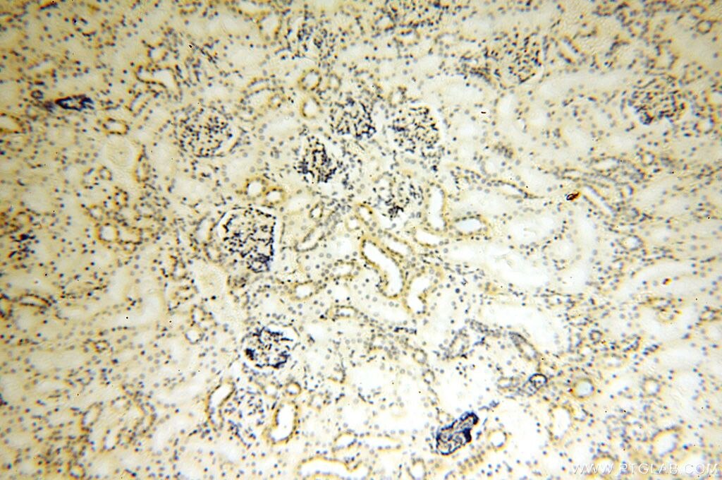 Immunohistochemistry (IHC) staining of human kidney tissue using MRPL52 Polyclonal antibody (16800-1-AP)