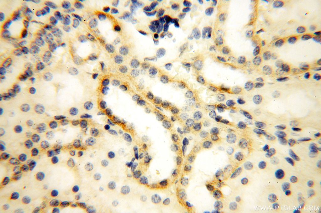 Immunohistochemistry (IHC) staining of human kidney tissue using MRPL52 Polyclonal antibody (16800-1-AP)