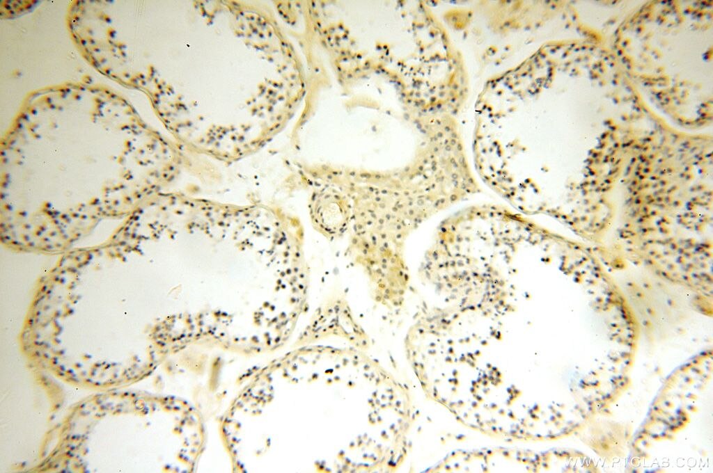 Immunohistochemistry (IHC) staining of human testis tissue using MRPL52 Polyclonal antibody (16800-1-AP)